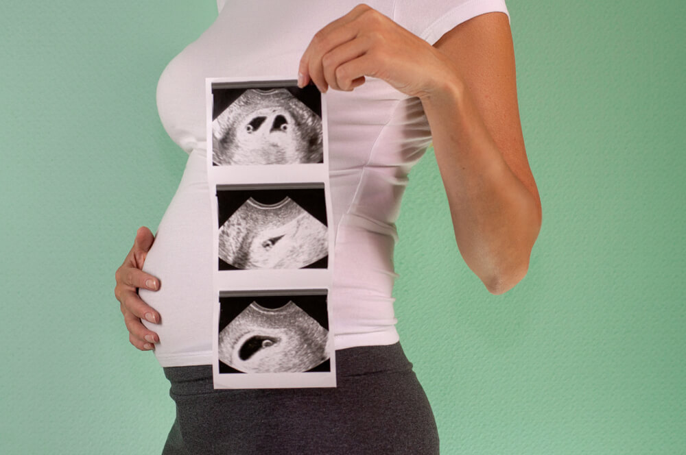 Waspadai! Risiko Gangguan Kesehatan Bila Hamil Kembar