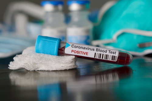 Indonesia Positif Coronavirus, Ini Langkah Pencegahannya