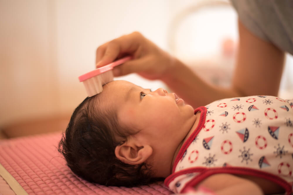 3 Cara Alami Mengatasi Kutu Rambut pada Bayi