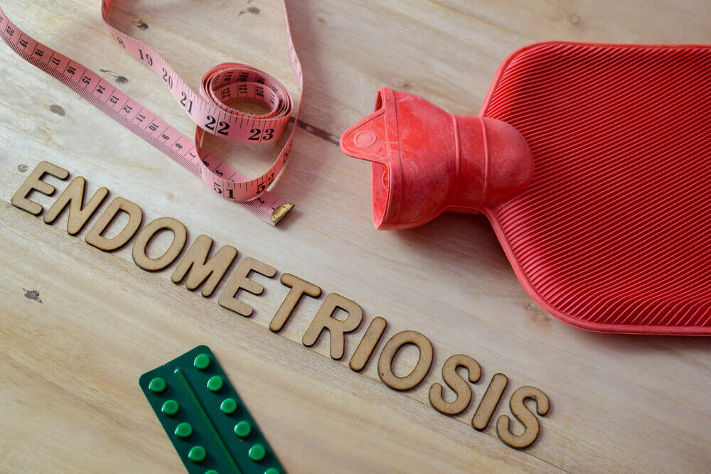 Endometriosis VS Fertilitas Wanita